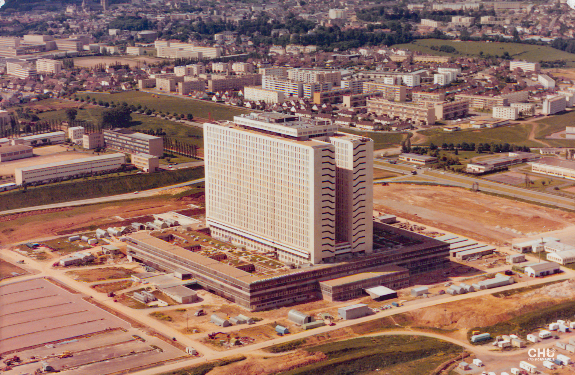 La tour du CHU du Caen après sa construction en 1975